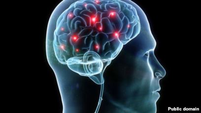 Image result for brain electrical activity