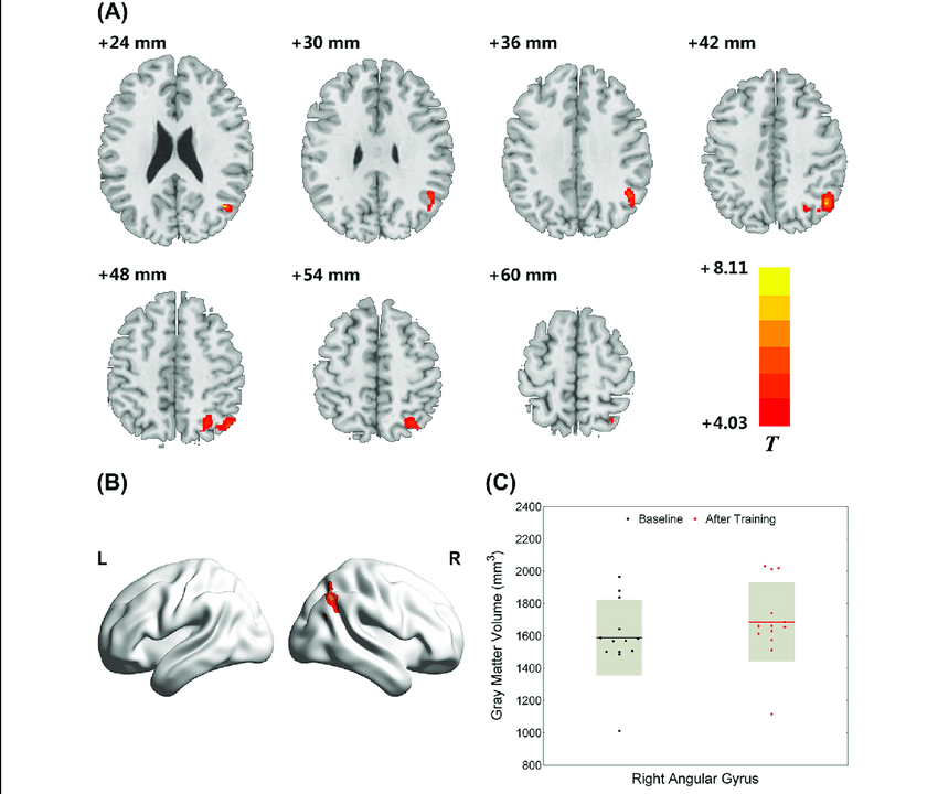Related image